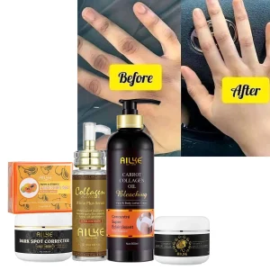 AILKE Kit schiarente al collagene, detergente, idratante, idratazione, crema per la rimozione delle macchie scure, lozione corpo sbiancante e schiarente